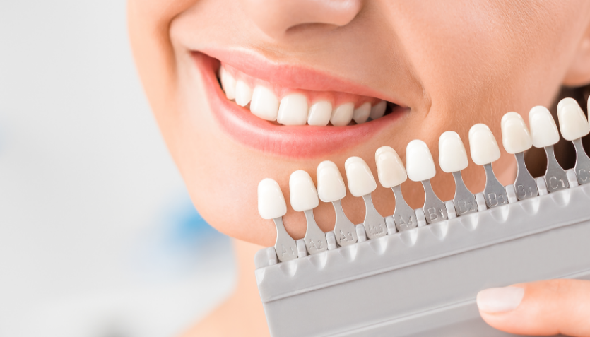 Woman smiling with set of veneers